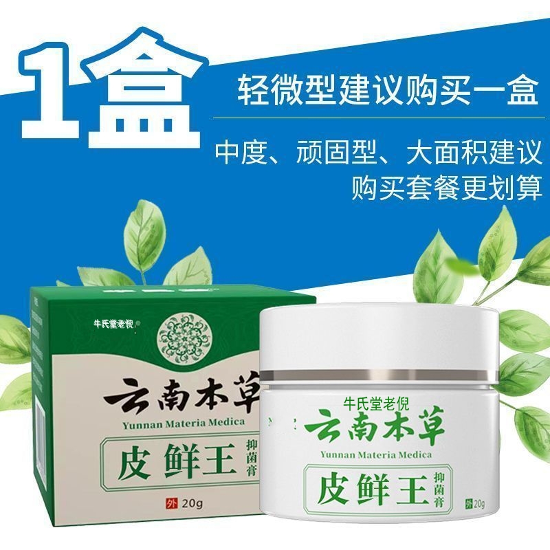 云南本草皮鲜王牛皮药膏头藓股银去屑杀皮肤菌止病症痒正品专用癣