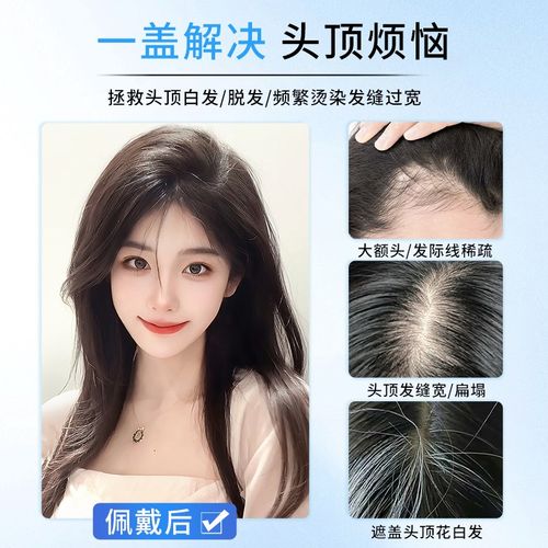 假发女片头顶补发全真人发蓬松增发量遮白发高颅顶自然无痕补发片