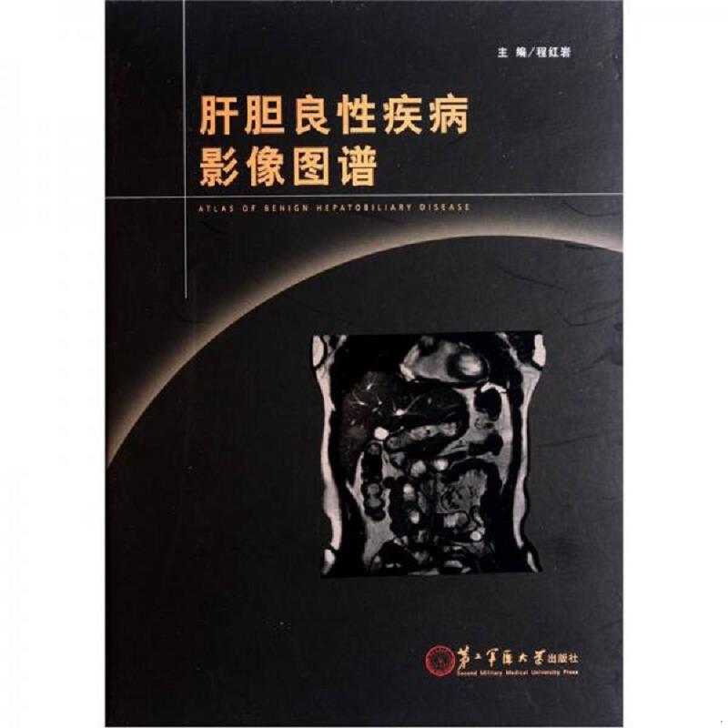 库存绝版书肝胆良性疾病影像图谱 9787548102496 程红岩主编 上海第二军医大学出版社
