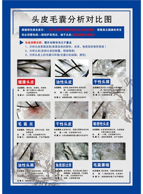 头皮毛囊分析对比图海报展板头皮理疗常见头皮归类毛囊细胞再生术