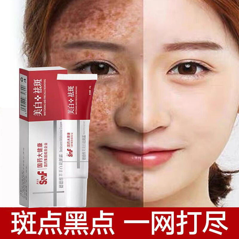 落昂氧丁 面霜修复液膏男女白斑通用美白祛斑霜络昂氧丁 咯昂氧丁,洗护清洁剂/卫生巾/纸/香薰,乳液/面霜,淘宝优惠券,粉丝福利购,淘宝优惠卷