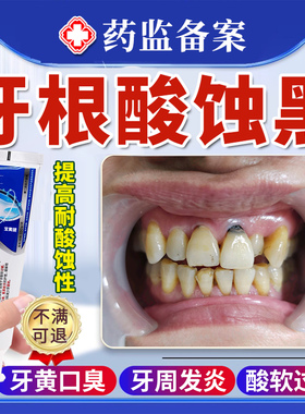 牙齿酸蚀牙根腐蚀变黑脱矿釉质楔状缺损修黑斑去除复含氟搭牙膏根