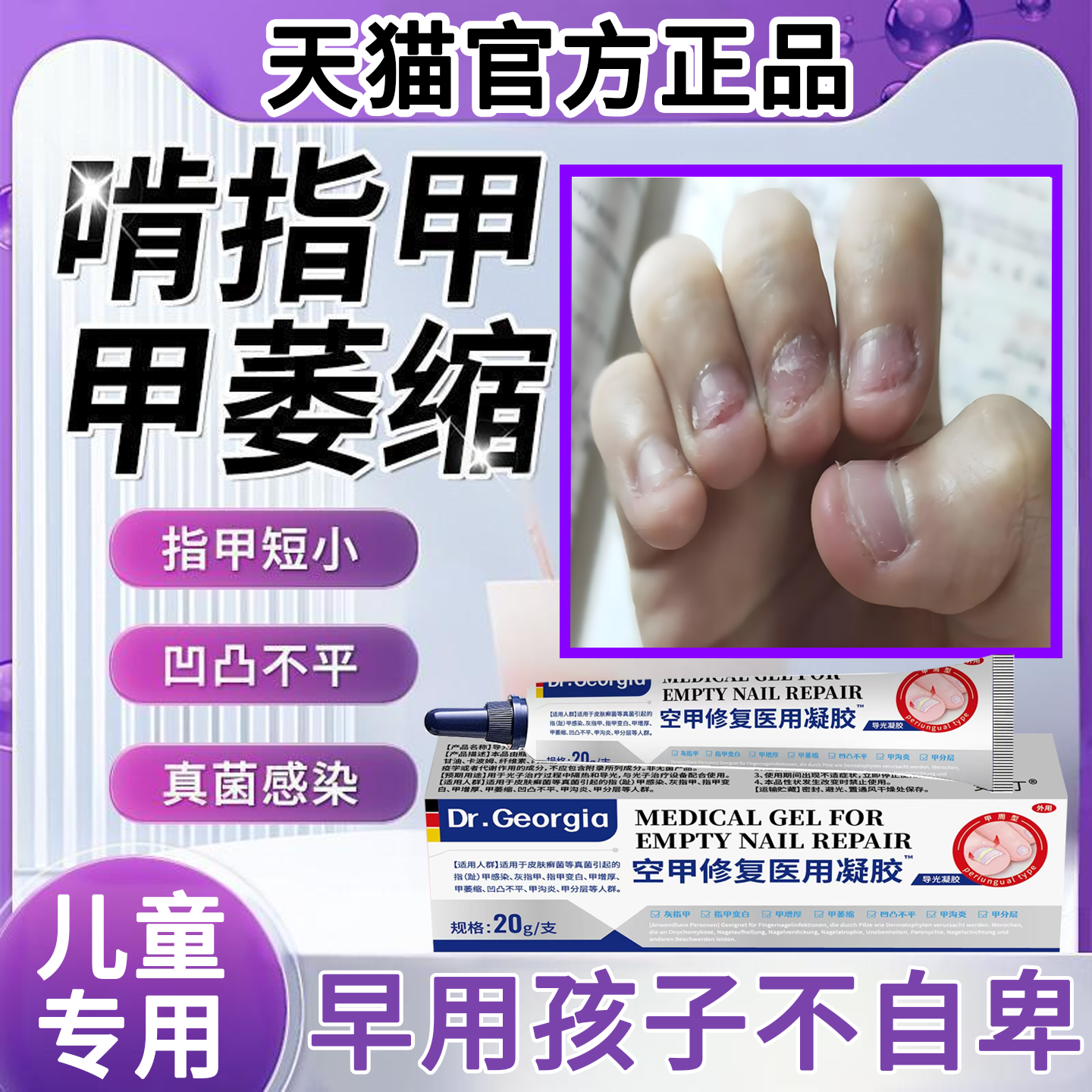 德国监制儿童啃咬手指甲霸榜第一