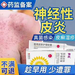 治疗神经性皮炎皮肤病癣藓湿疹真菌感染瘙痒皮炎湿痒止痒皮癣药膏