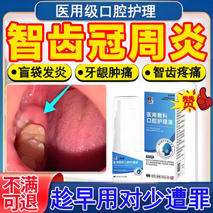 智齿冠周炎发炎漱口水牙龈牙根上火消炎牙齿肿痛喷雾剂药房同售