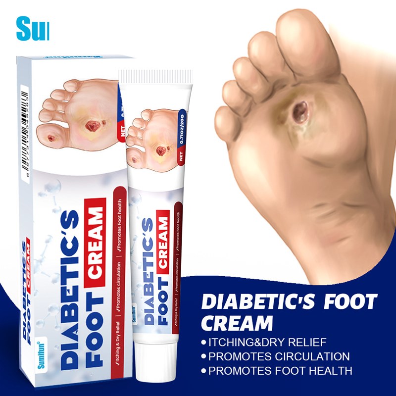 Diabetics Foot Ulcer Cracking Redding Itching DiabetYic Fee