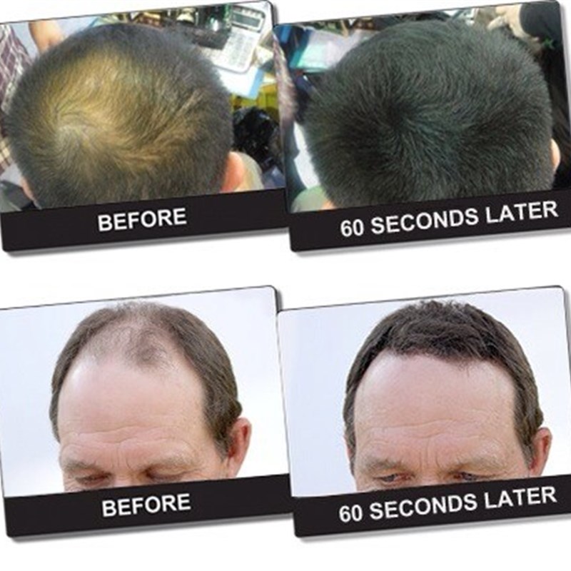 密丰增发纤维假发密发粉补充包袋装补发生发美发快速浓头发稀120g