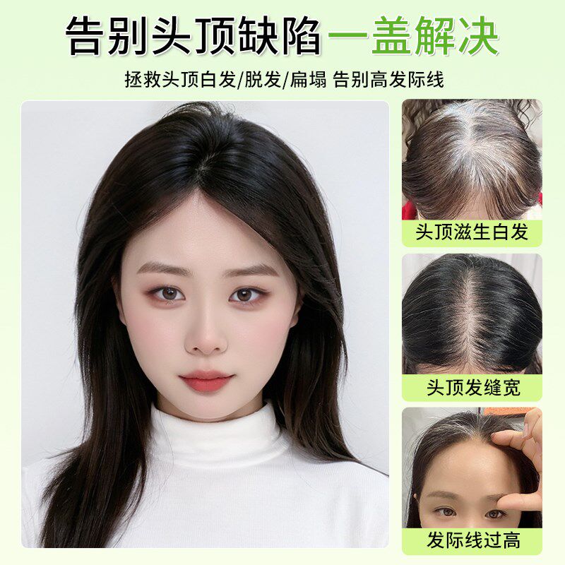 高颅顶假发片双递针真发全真人发增发量蓬松头顶自然无痕补发片女