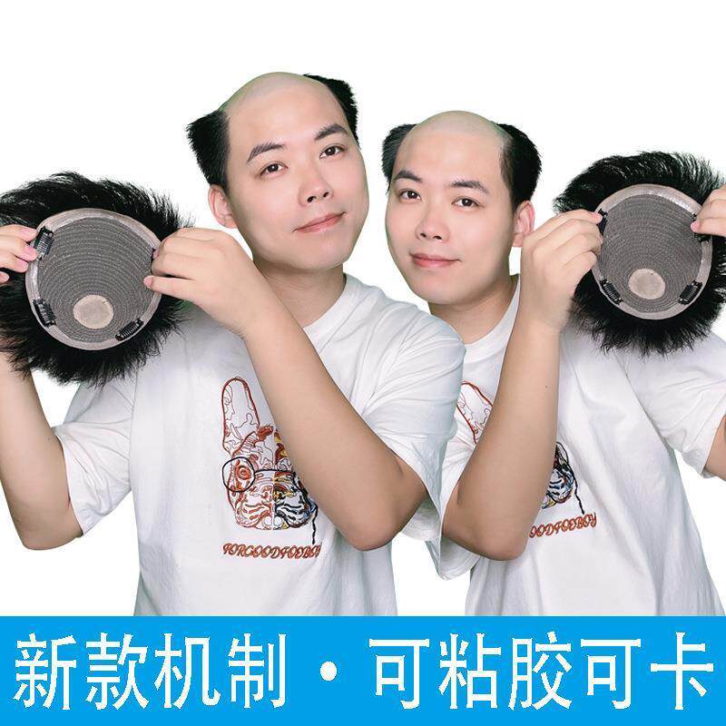 真发补发片男补发块机制可黏胶卡子新款网红假发中分浏海短发自然