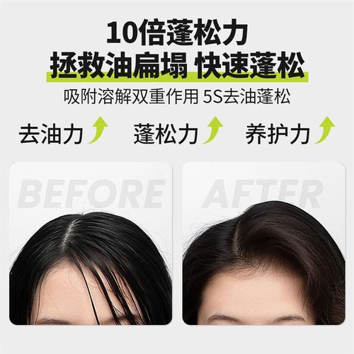 干发喷雾免洗去油蓬松清爽高颅顶神器头发控油神器UOIO