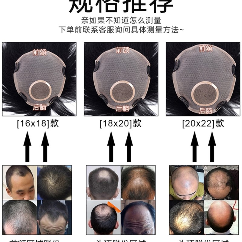 假发男短发毛寸真发无痕隐形假发片自然男士可卡轻薄头顶补发片