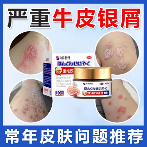 本桑制药医用级牛皮藓银屑真菌抑菌皮肤瘙痒退热皮肤型外官方正品