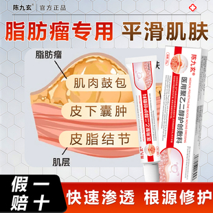 陈九玄脂肪瘤消瘤膏去除神器皮下肿硬块特皮肤纤维脂腺囊肿外用