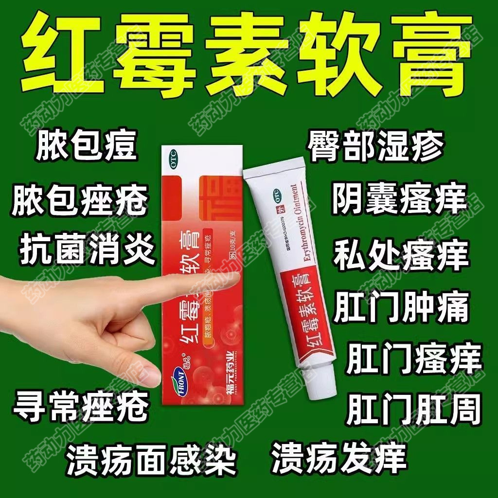 福元红霉素软膏10g/支抗菌消炎止痒治脓疱疮青春痘毛囊炎溃面感LL