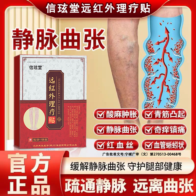 静脉曲张蚯蚓腿红血丝小腿酸痛足跟肿胀