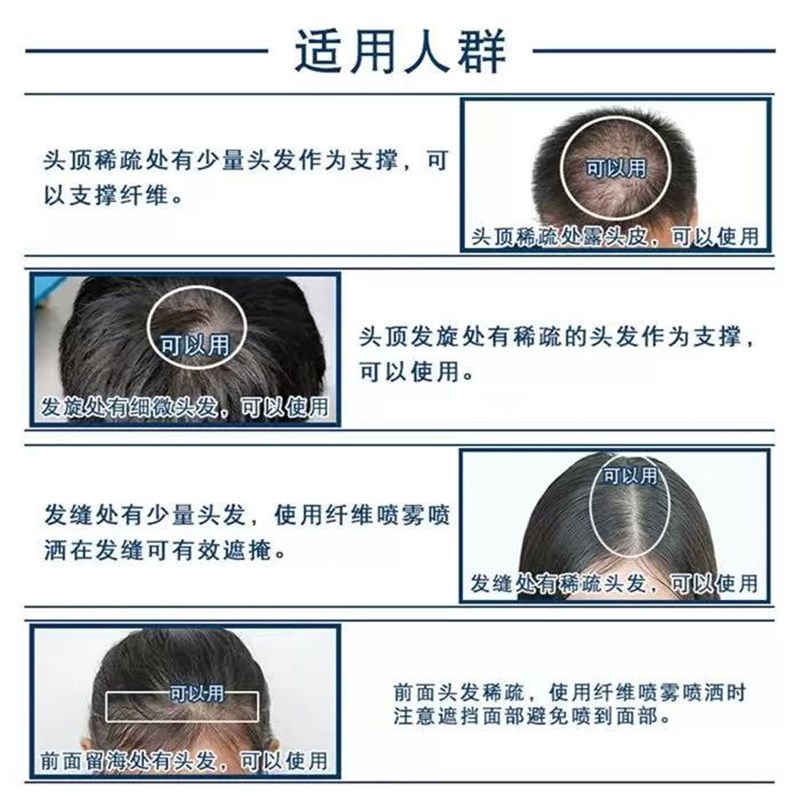 toppik增发纤维粉发际线 线喷雾补发头顶密发神器假发纤维美发粉