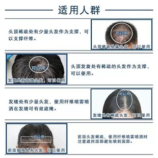 toppik增发纤维粉发际线 线喷雾补发头顶密发神器假发纤维美发粉