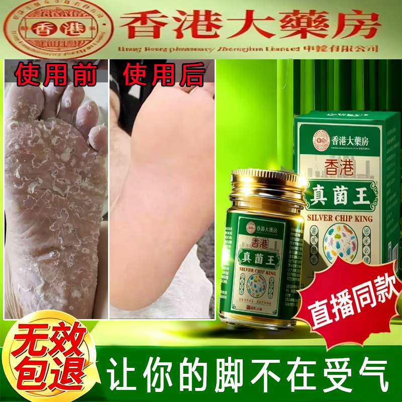 香港真菌王大药房草本萃取手足干裂皮肤瘙痒抑菌全身适用止痒药膏