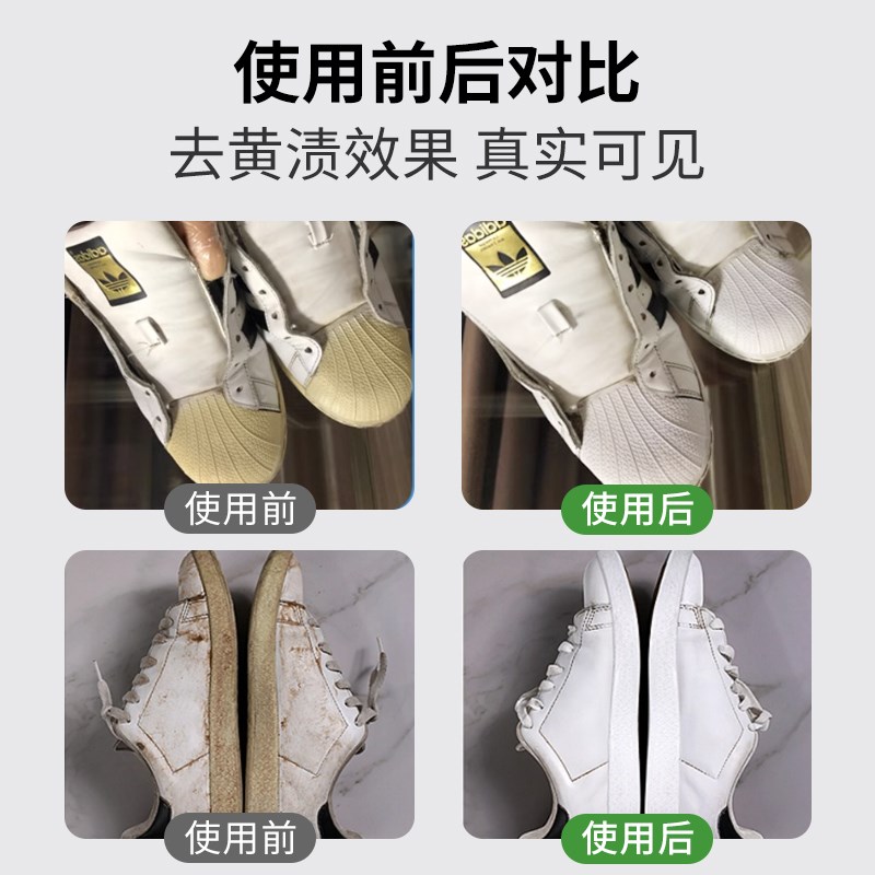 小白鞋子鞋边去黄去氧化增白y还原剂清洗去污鞋底发黄修复神器