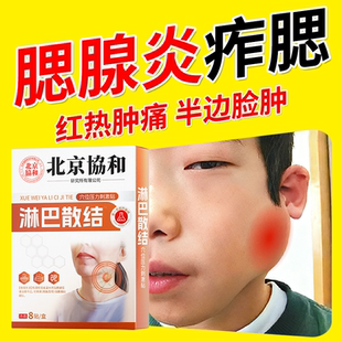 腮腺炎膏药贴散结儿童成人痄腮淋巴结肿大咬肌疼痛颞下颌关节紊乱