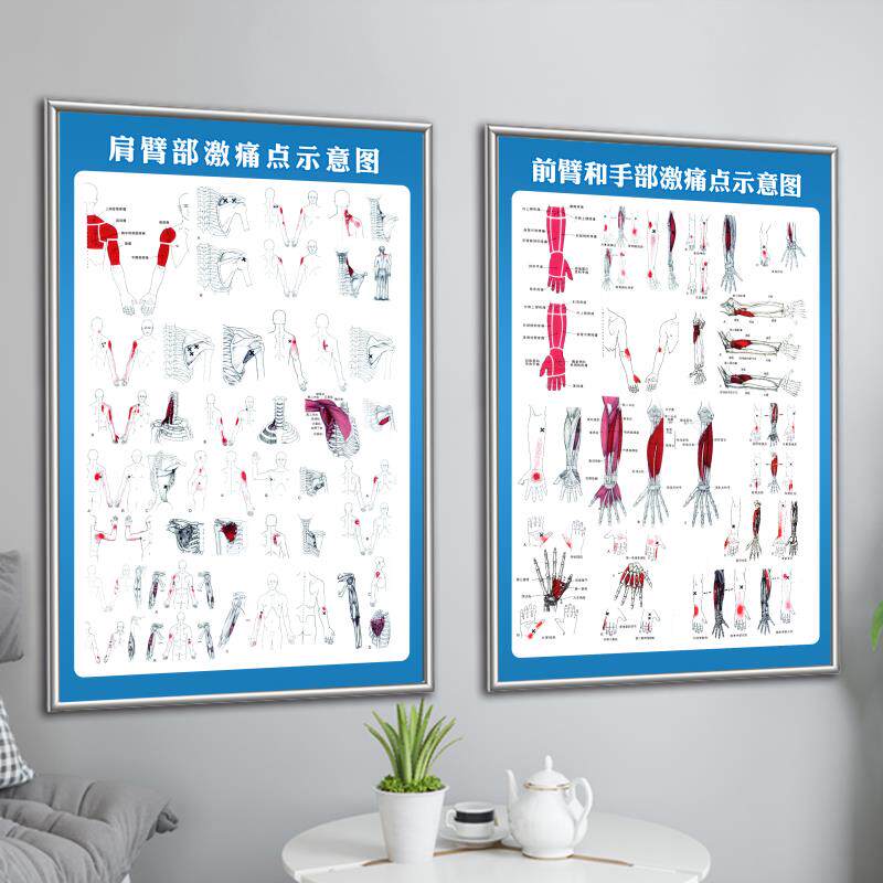 肌筋膜疼痛触发点挂图激痛点示意图全身人体肌肉解剖图骨骼结构图