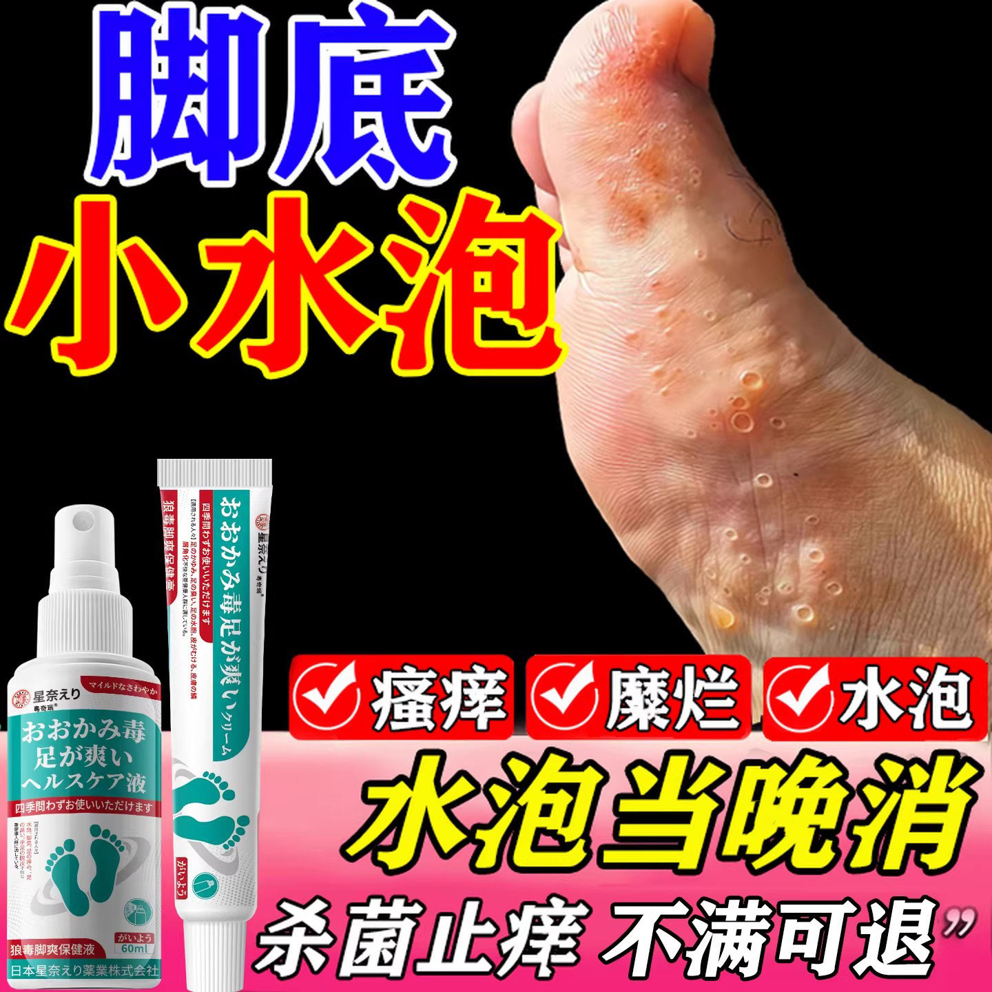 脚气脚痒脱皮真菌感染糜烂脚趾水泡型臭脚止汗止痒脱皮杀菌止痒膏