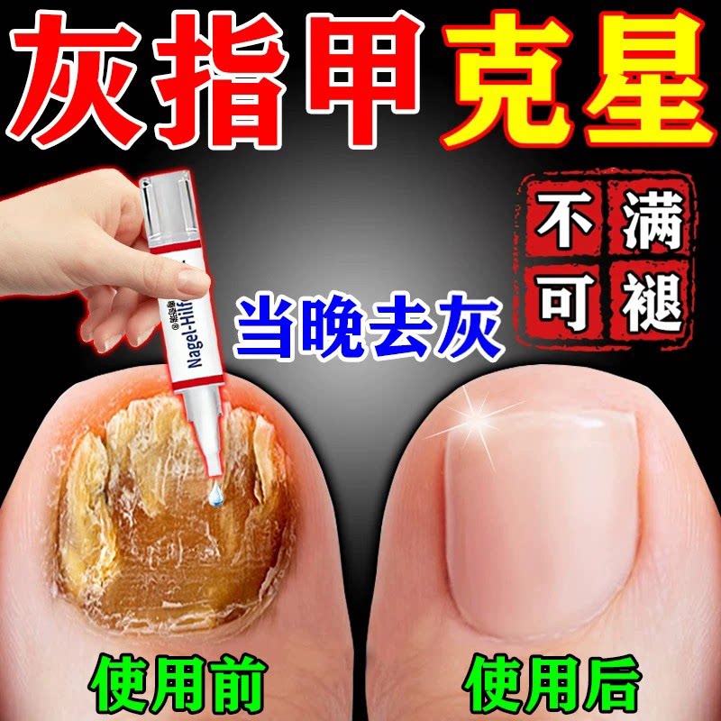 【一抹焕新】德国进口技术治甲
