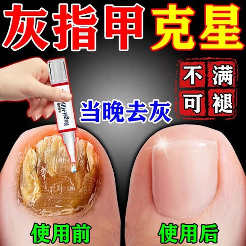 【一抹焕新】德国进口技术治甲