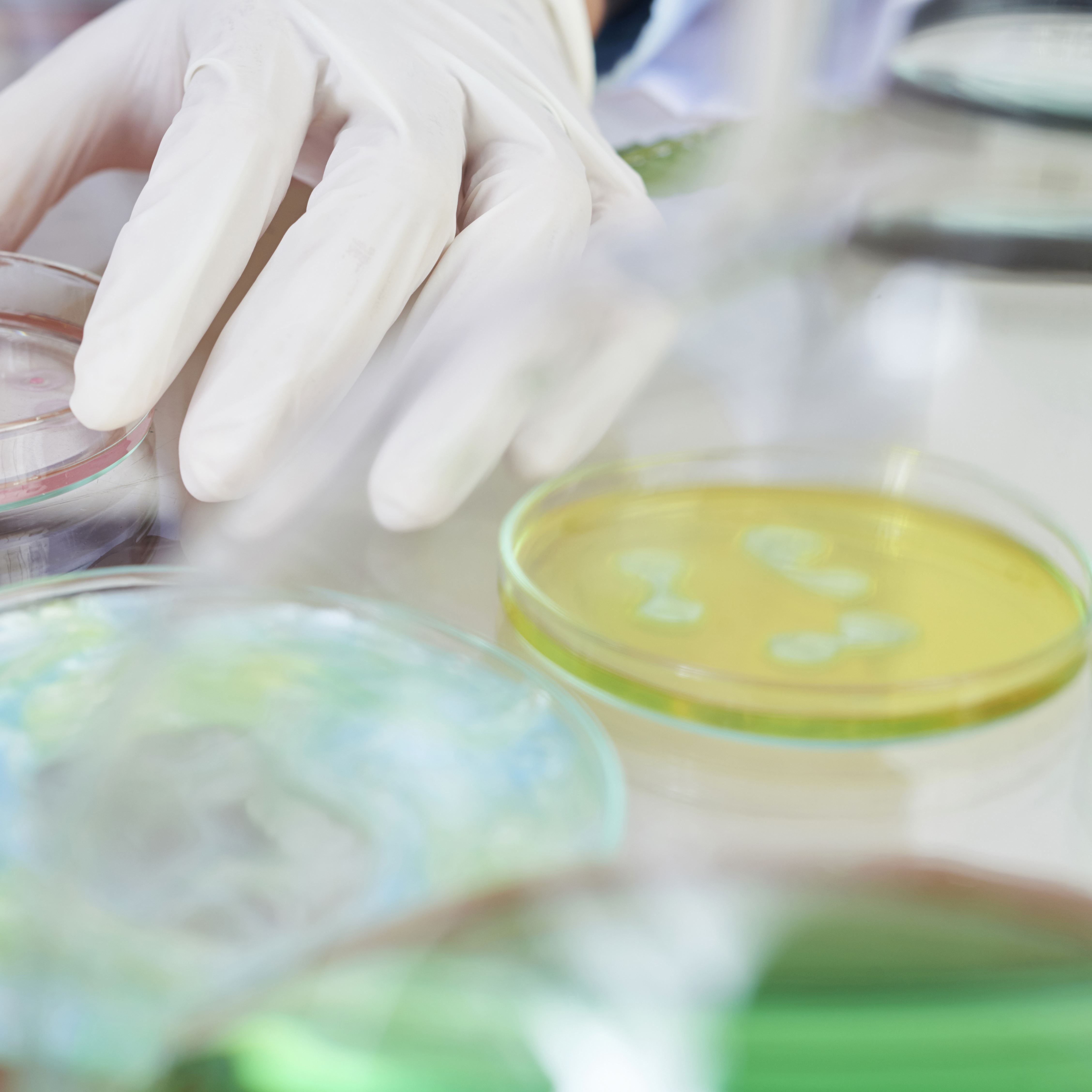 树兰医疗 【居家检测】阴道微生态居家检测