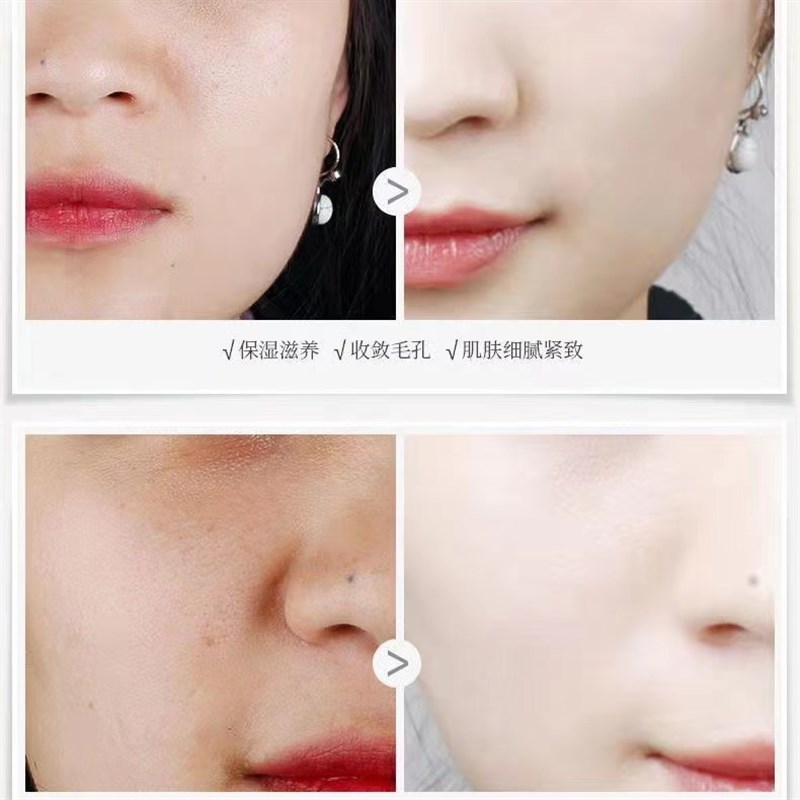 化妆品尿素食品级原粉护肤品乳膏霜保湿专用医用纯尿素原料保湿剂