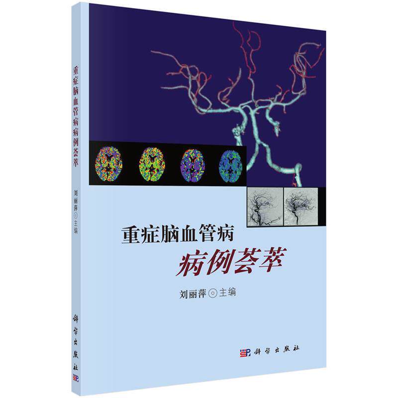 【正版书】 重症脑血管病病例荟萃 刘丽萍 科学出版社有限责任公司