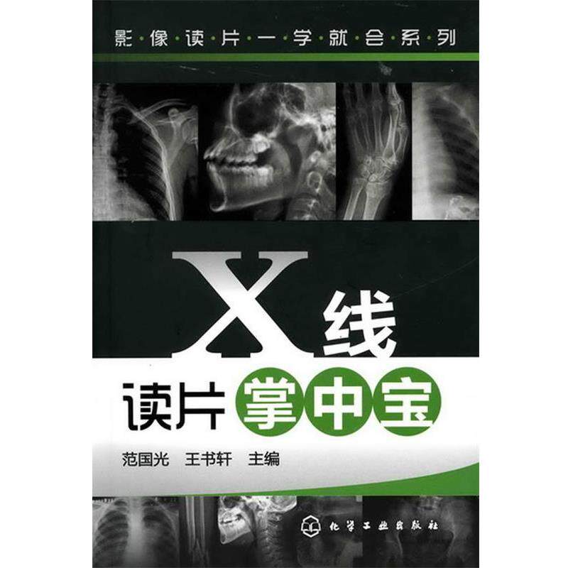 【正版书】 影像读片一学就会系列--X线读片掌中宝 范国光,王书轩 主编 化学工业出版社