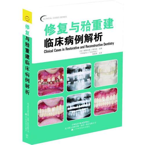 【正版书】 修复与牙合重建临床病例解析 (美)塔兰托 编 辽宁科学技术出版社