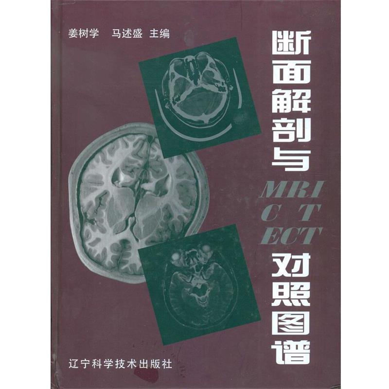 【正版书】 断面解剖与MRI CT ECT对照图谱 姜树学,马述盛 主编 辽宁科学技术出版社