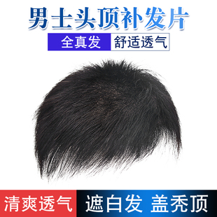假发男短发真人发男士秃顶前额头顶补发块隐形无痕自然帅气补发片