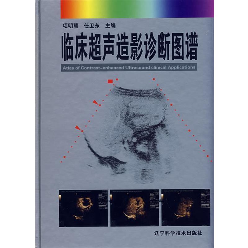 【正版书籍】 临床超声造影诊断图谱 项明慧,任卫东 主编 辽宁科学技术出版社