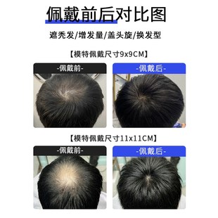 假发片男士头顶补发块遮盖头旋发缝伤疤脱发稀少隐形自然全真人发