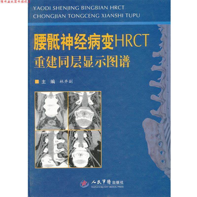 【正版书】 腰骶神经病变HRCT重建同层显示图谱 林井副 编 人民军医出版社