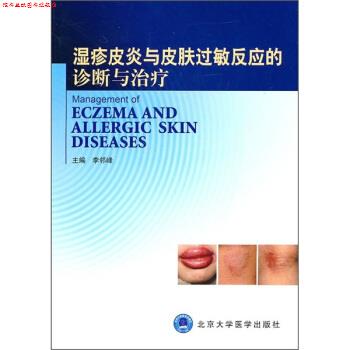 【正版书】 湿疹与皮肤过敏反应的诊断与 李邻峰 编 北京大学医学出版社