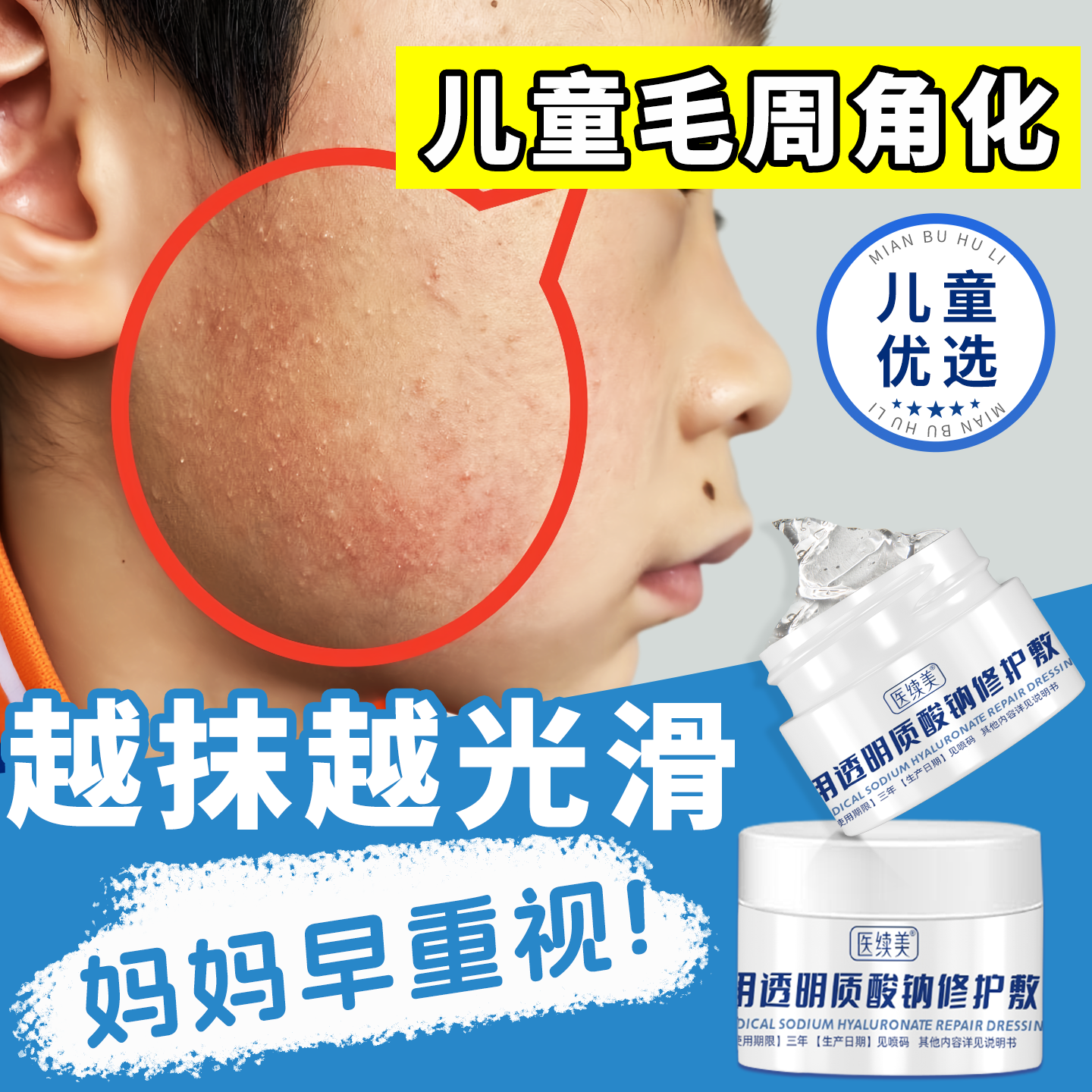 儿童毛周角化面霜搭药膏青少年改善鸡皮肤毛囊疙瘩去除面部脸上QN