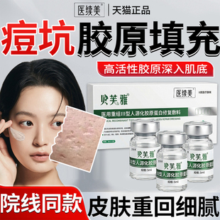 痘坑凹洞填充再生医用重组三型人源化胶原蛋白去修复敷料除痘印QN