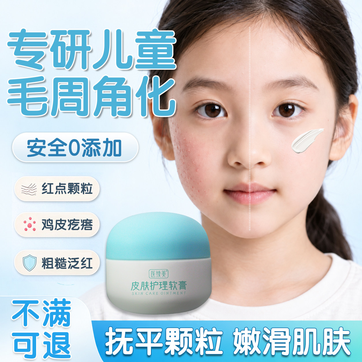 儿童毛周角化面霜去除神器鸡皮肤疙瘩毛囊角化症专面部用搭药膏ZJ