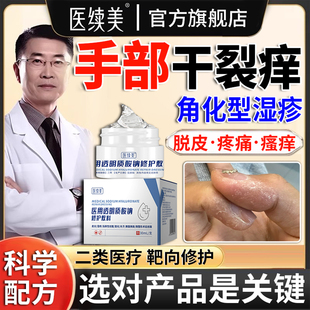 角化型手部湿疹角质型手指手癣膏脱皮干裂真菌感染专用皲裂手足QN