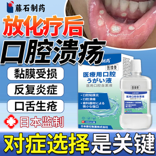 放疗化疗后口腔溃疡含漱液口腔黏膜修复喷雾剂口舌生疮漱口水YG
