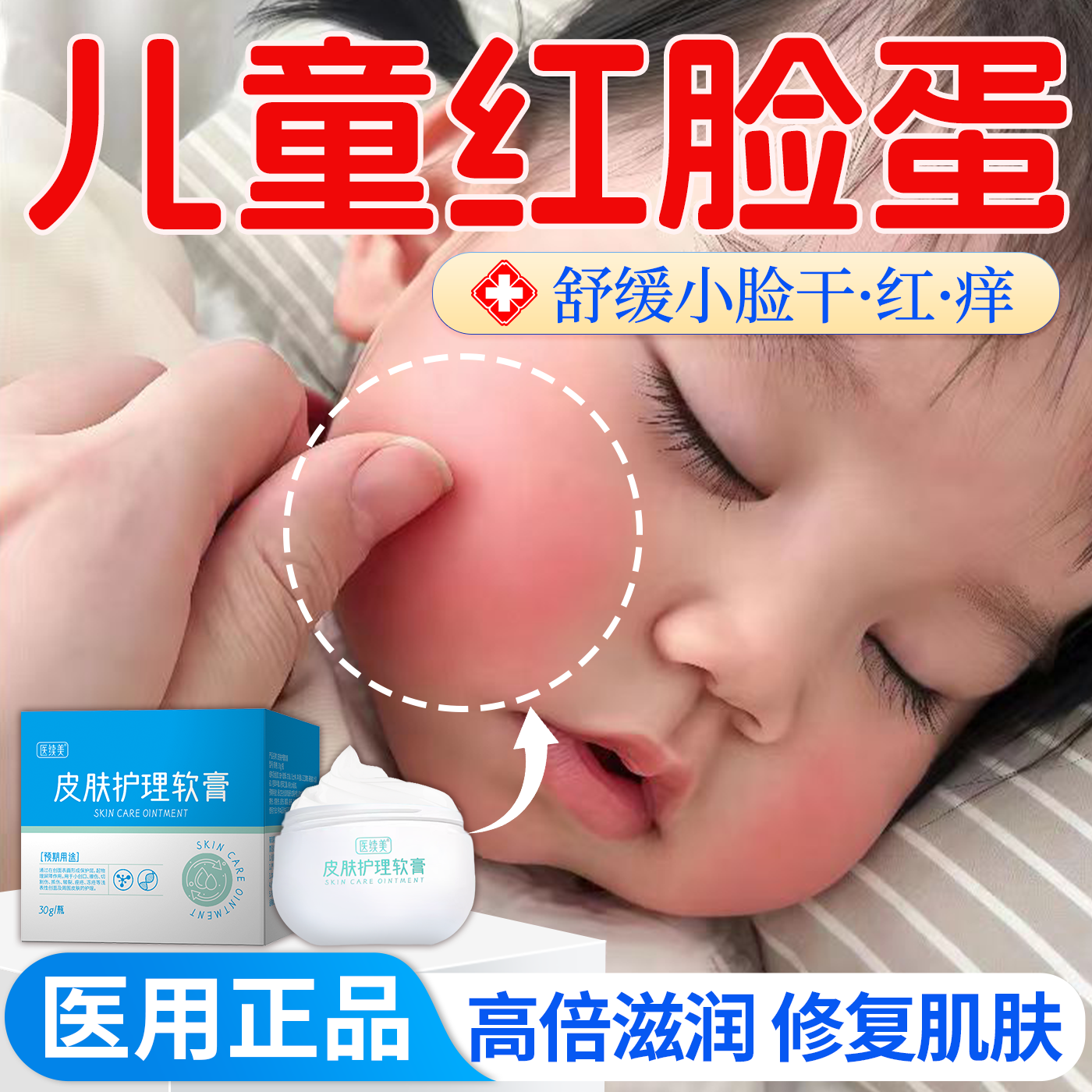 儿童宝宝红脸蛋面霜高原红血丝冻疮肌肤屏障受损修复敏感肌保湿QN,医疗器械,伤口敷料,淘宝优惠券,粉丝福利购,淘宝优惠卷