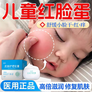 儿童宝宝红脸蛋面霜高原红血丝冻疮肌肤屏障受损修复敏感肌保湿QN