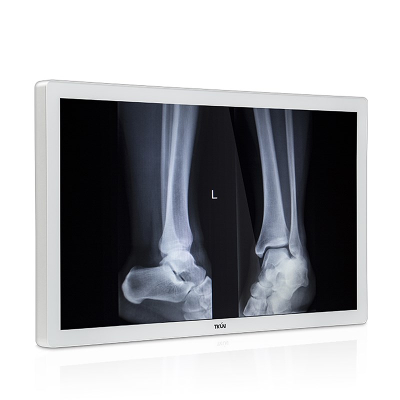 27/32寸高亮高清医用显示器8M诊断医疗灰阶4K监视器 K天堃工控