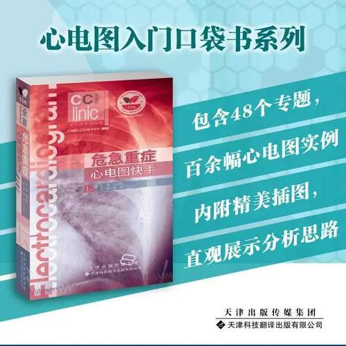 危急重症心电图快手危急重症患者心电图读图心动过缓房室阻滞