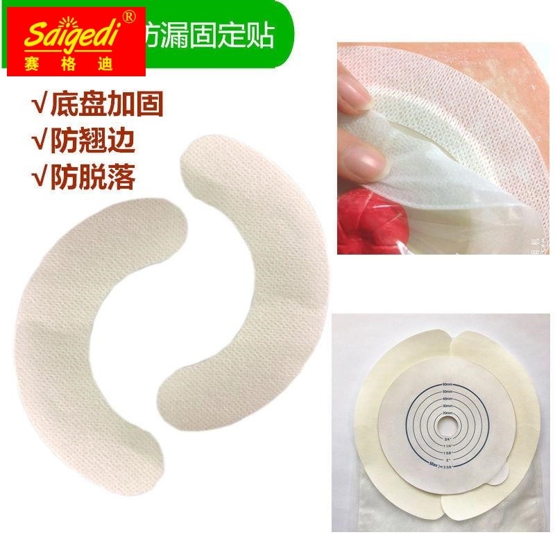 造口袋加固条压敏胶带水刺底盘防漏环造瘘袋护理附件产品