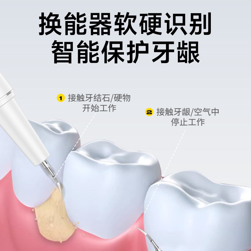 【C&M】超声波洗牙器冲牙结石去除神器洁牙仪牙齿污垢家用